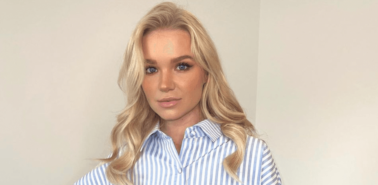 Abbie Quinnen praised for bravely showing scars following fire stunt with AJ Pritchard