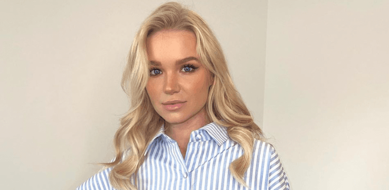 Abbie Quinnen praised for bravely showing scars following fire stunt with AJ Pritchard Abbie Quinnen praised for bravely showing scars following fire stunt with AJ Pritchard