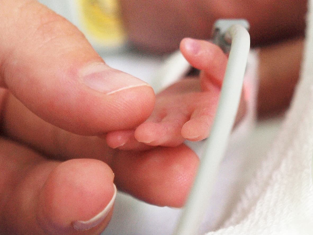 “World’s most premature baby” given 0% chance of survival celebrates first birthday