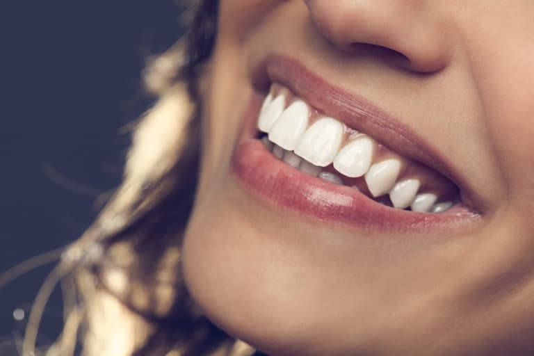 Want to smile with confidence? Here’s how you can conveniently straighten your teeth at home Want to smile with confidence? Here’s how you can conveniently straighten your teeth at home