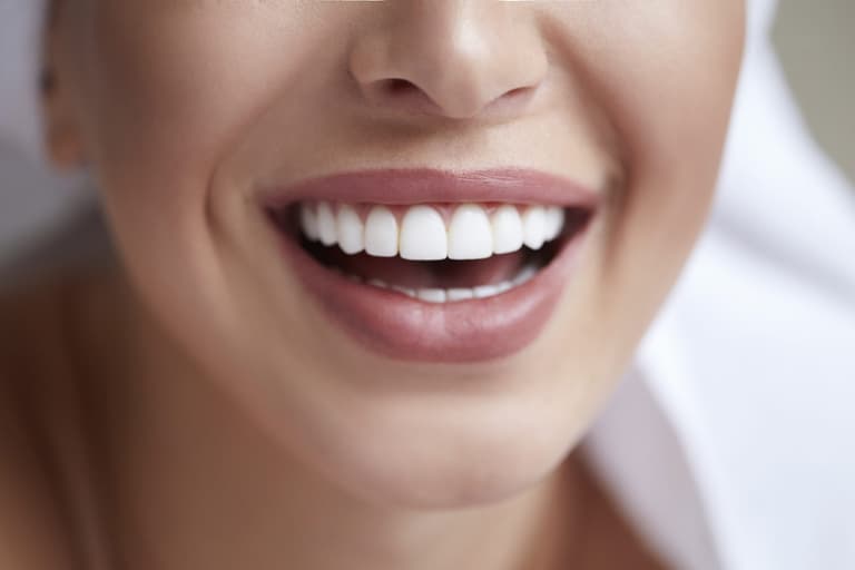 Everything you need to know about straightening your teeth at home Everything you need to know about straightening your teeth at home