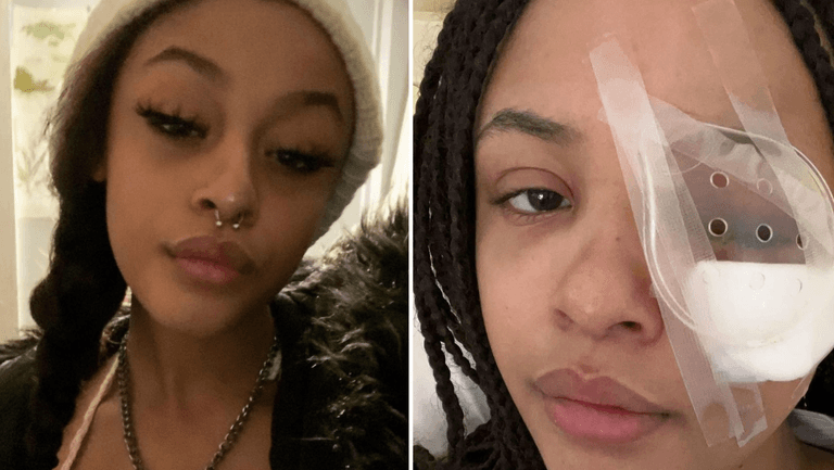 Two arrested following assault on 17-year-old-girl Two arrested following assault on 17-year-old-girl