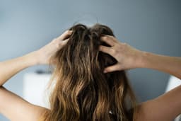 WIN: Everything you need to get rid of dandruff for good
