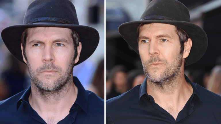 Comedian Rhod Gilbert shares that his cancer is stage 4 Comedian Rhod Gilbert shares that his cancer is stage 4