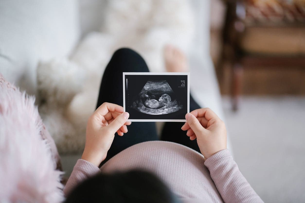Mum refuses to tell partner gender of their baby after he skipped scan to go to the chippy