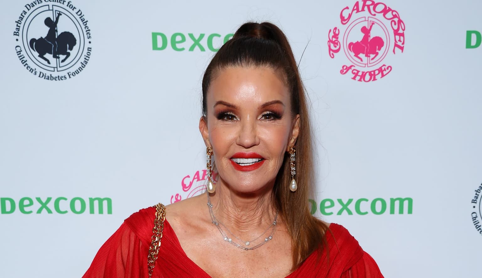 Janice Dickinson hints she had a nasty fall on I’m A Celeb All Stars