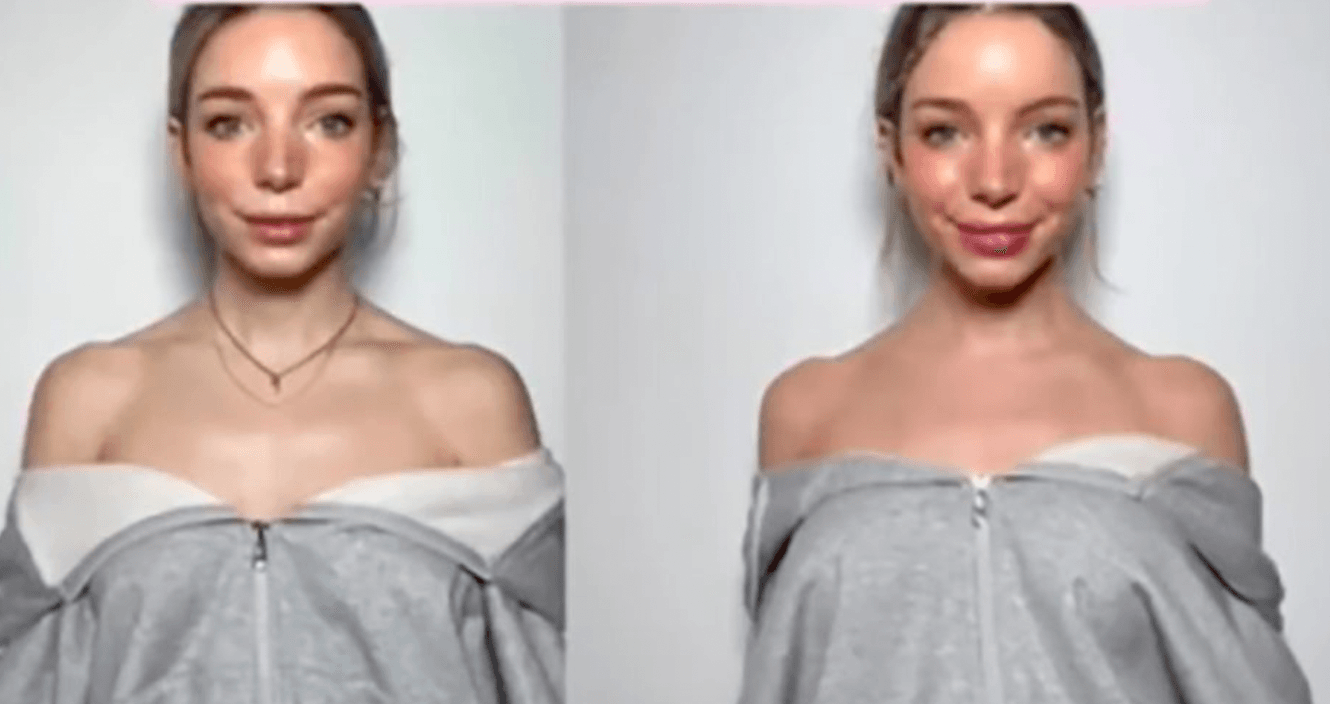 ‘Barbie botox’ is the latest trend that is absolutely sending us