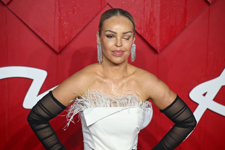 ‘I’ve got a defect and an infection’ – Katie Piper updates fans after surgery to ‘avoid losing her eye’