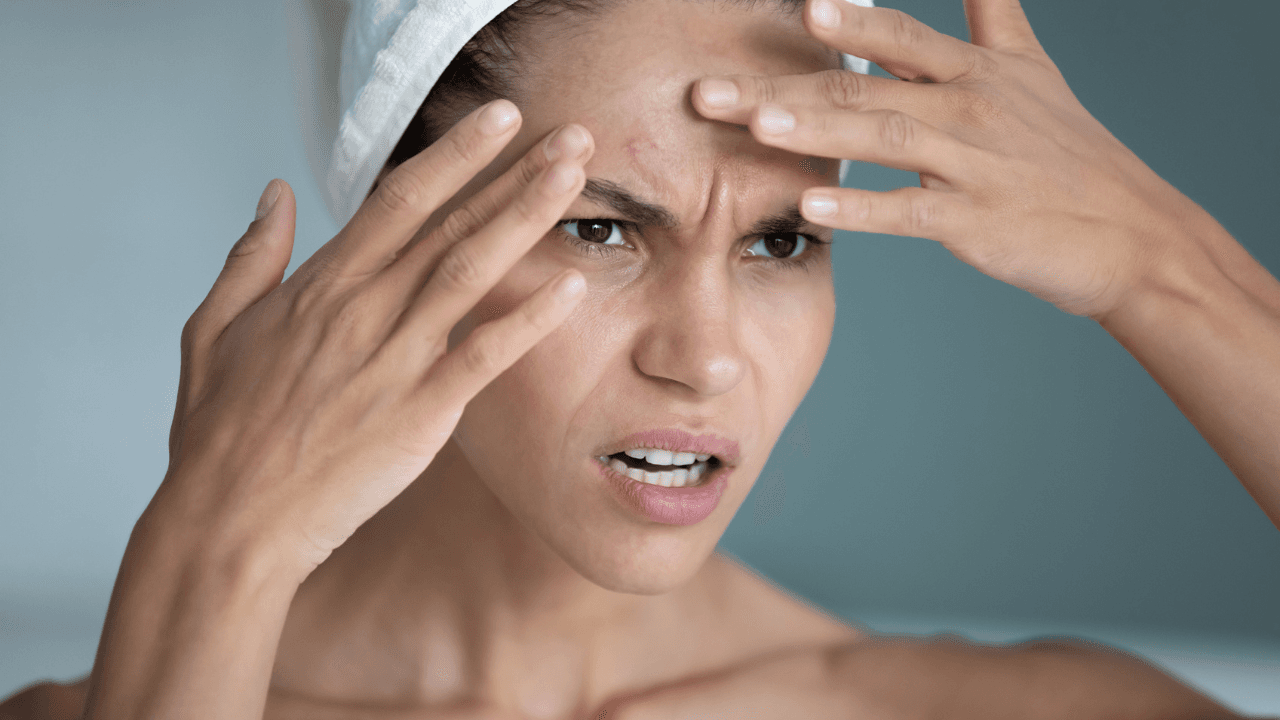 Dermatologist reveals the type of spot you really should leave alone