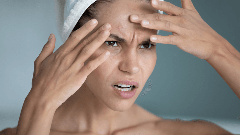 Dermatologist reveals the type of spot you really should leave alone Dermatologist reveals the type of spot you really should leave alone