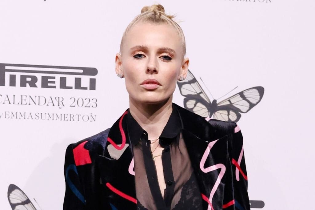 Model issues warning after losing both legs to toxic shock syndrome