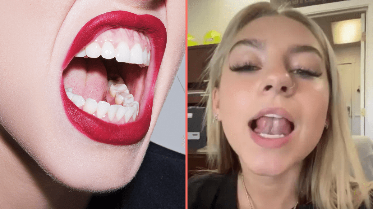 ‘Gleeking’ is the ‘disgusting’ bodily function that most people don’t know they can do