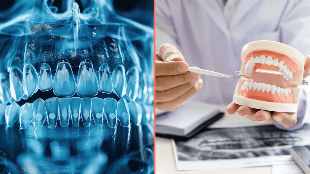 Cause of Alzheimer’s might be coming from inside your mouth, scientists find