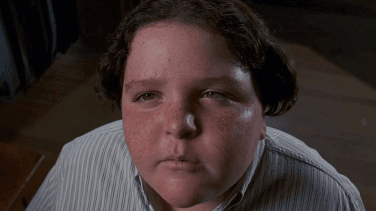 Bruce Bogtrotter star unrecognisable after quitting acting to become a doctor