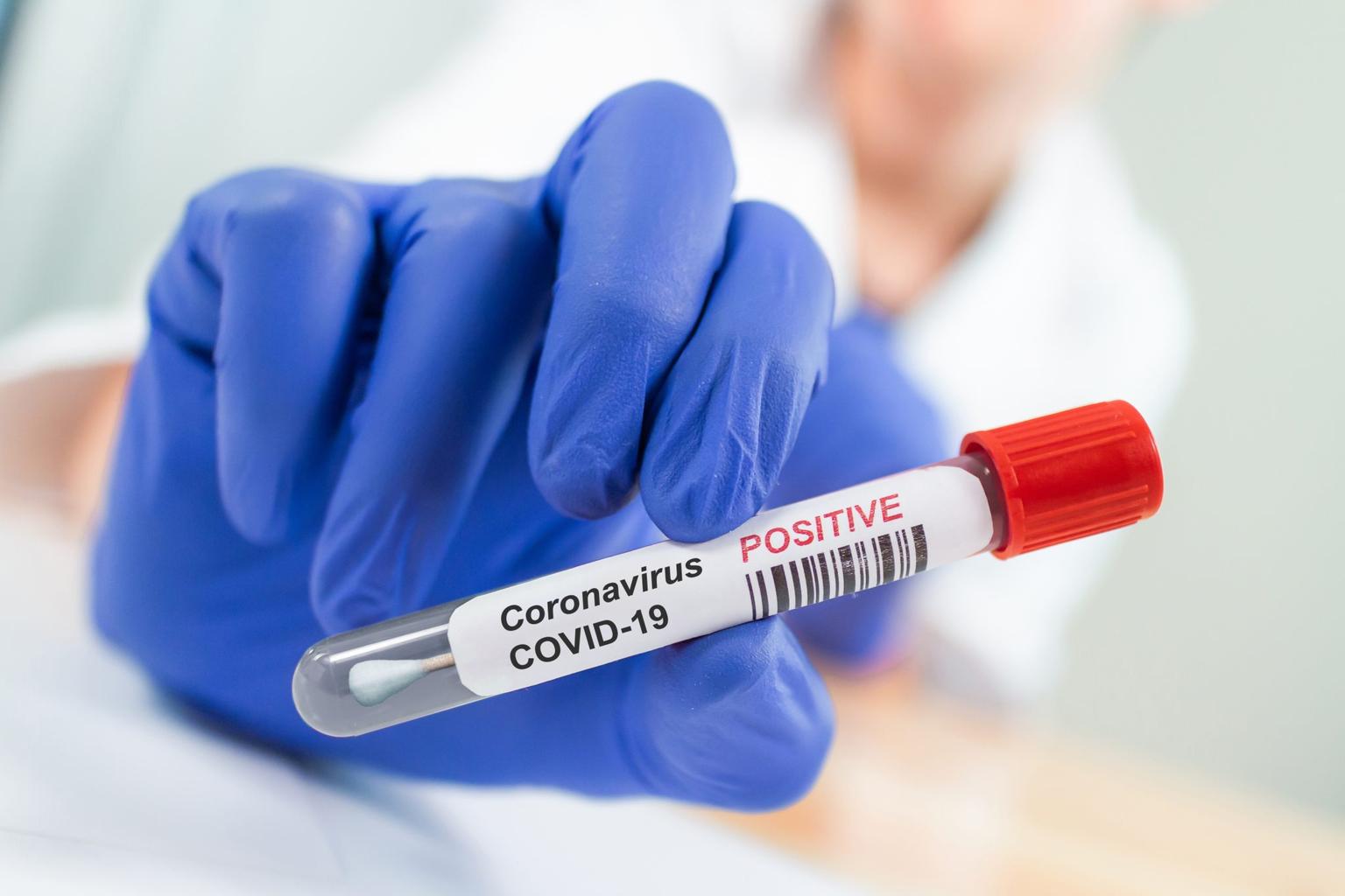 HSE issues warning as young people “intentionally” contracting Covid-19 for vaccine passports
