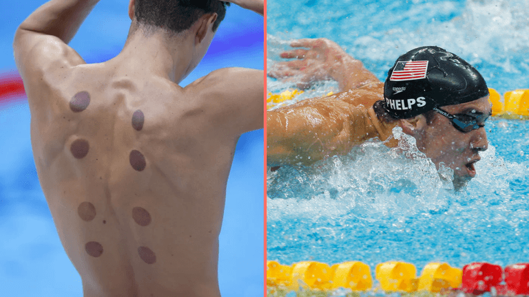 What are the dark circles on swimmers’ backs at Paris Olympics