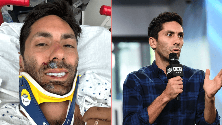 Catfish star Nev Schulman breaks neck in horror collision