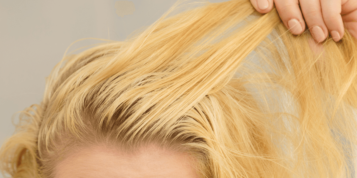Struggling with greasy hair? A Dermatologist has shared exactly what to do