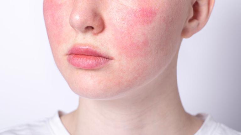 Dermatologist issues advice for anyone struggling with ‘Autumn face’