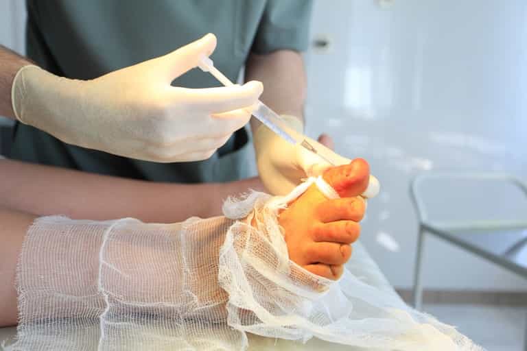 New Cosmetic Surgery Tackles Problem of Fat Toes, “Toe-besity” New Cosmetic Surgery Tackles Problem of Fat Toes, “Toe-besity”