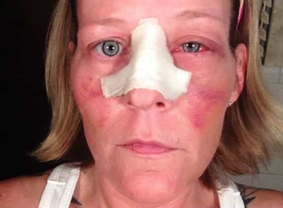 “Does this look like LOVE TO ANYONE OF YOU?” – Woman Posts Shocking Pictures of Domestic Violence to Her Facebook Account “Does this look like LOVE TO ANYONE OF YOU?” – Woman Posts Shocking Pictures of Domestic Violence to Her Facebook Account