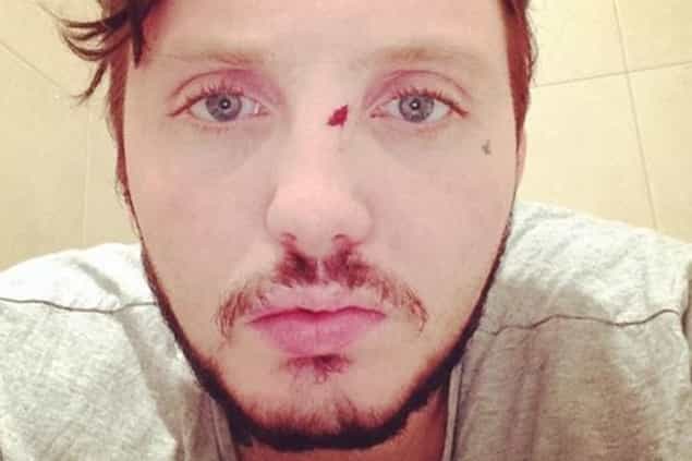 X Factor Star Involved In Bar Brawl In Poland X Factor Star Involved In Bar Brawl In Poland