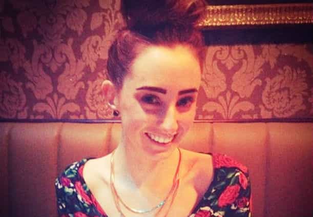 “Why Don’t I Have Boobs Yet? Why Don’t I Have a Straight Body?” Living with Scoliosis – One Young Irish Woman Shares Her Story “Why Don’t I Have Boobs Yet? Why Don’t I Have a Straight Body?” Living with Scoliosis – One Young Irish Woman Shares Her Story