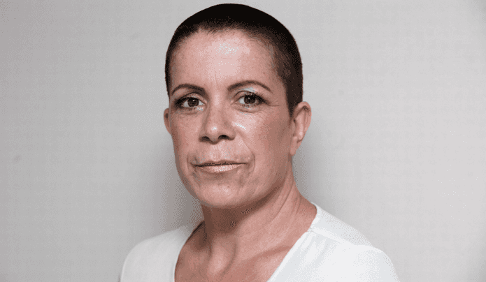 Mum-Of-Two Forced To Shave Head After Hair Extensions Were Put In With Super Glue Mum-Of-Two Forced To Shave Head After Hair Extensions Were Put In With Super Glue