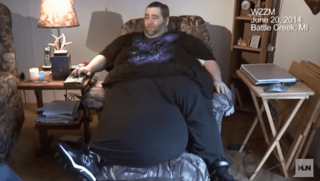 Man With 100lb Scrotum To Have Surgery To Achieve A Smaller Package Man With 100lb Scrotum To Have Surgery To Achieve A Smaller Package