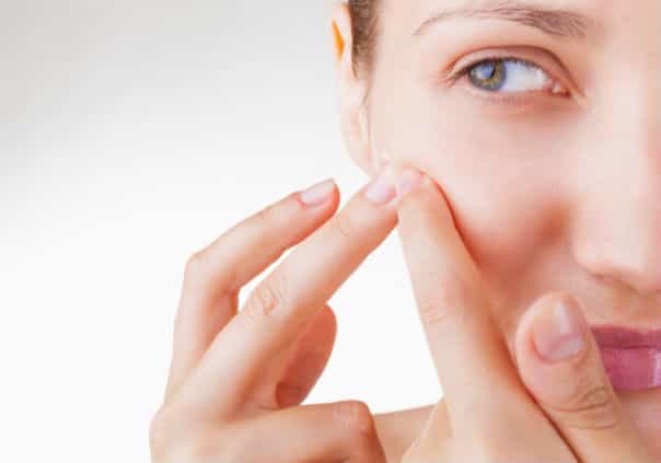Her Check-Up: Overcoming Acne Her Check-Up: Overcoming Acne
