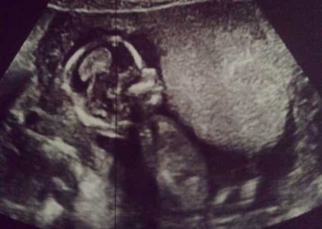 Irish Singer Announces Pregnancy on Instagram Irish Singer Announces Pregnancy on Instagram