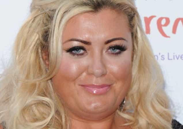 Gemma Collins Allegedly Assaulted by Boyfriend Gemma Collins Allegedly Assaulted by Boyfriend