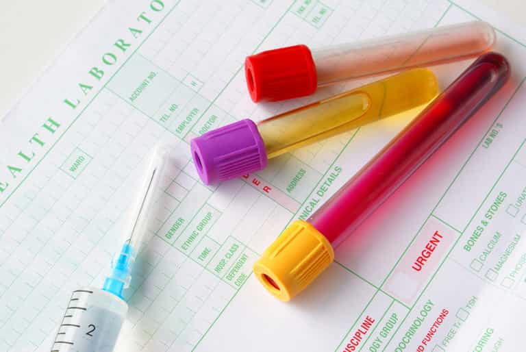 CervicalCheck see 180 samples expire in capacity issue CervicalCheck see 180 samples expire in capacity issue
