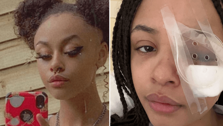 Gardaí appeal for witnesses following assault on teenage girl Gardaí appeal for witnesses following assault on teenage girl