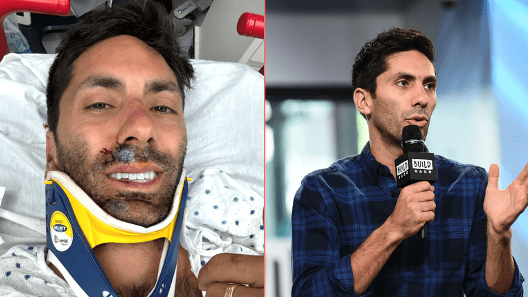 Catfish star Nev Schulman breaks neck in horror collision Catfish star Nev Schulman breaks neck in horror collision