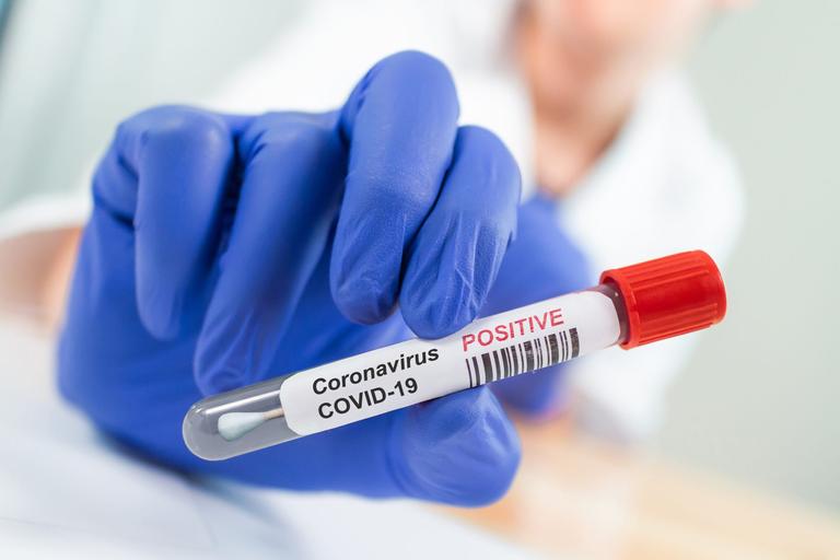 HSE issues warning as young people “intentionally” contracting Covid-19 for vaccine passports HSE issues warning as young people “intentionally” contracting Covid-19 for vaccine passports