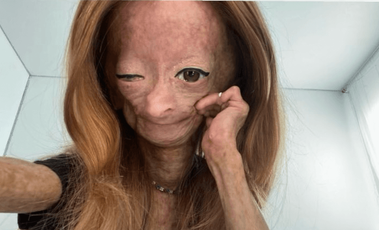 YouTube star Adalia Rose dies, aged 15 YouTube star Adalia Rose dies, aged 15