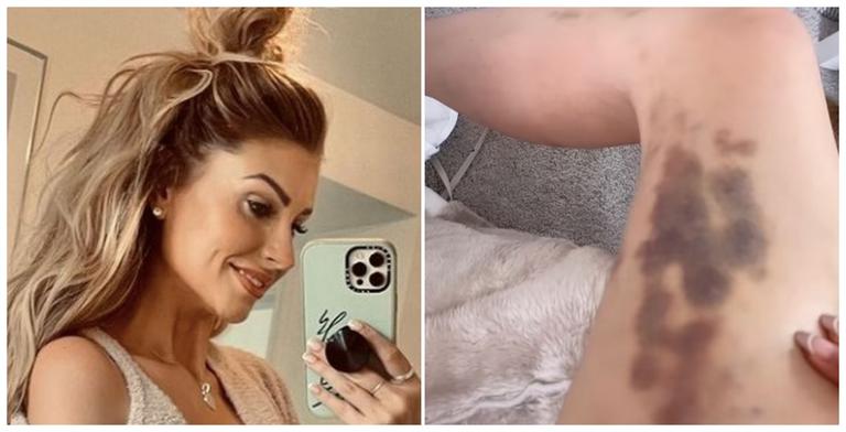 Mrs Hinch on why she always covers up – even in summer Mrs Hinch on why she always covers up – even in summer