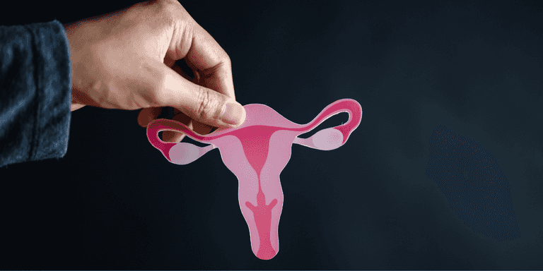 Understanding PCOS: Six mistakes that can worsen your symptoms, according to a GP Understanding PCOS: Six mistakes that can worsen your symptoms, according to a GP