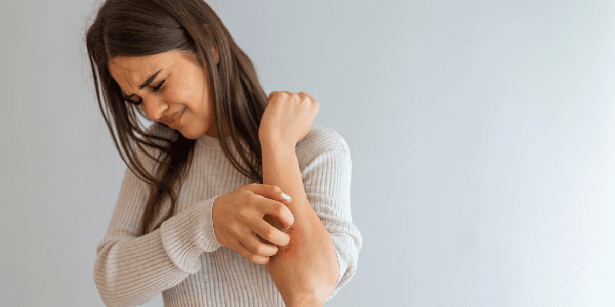 One in ten adults in Ireland suffer with eczema – top tips for soothing and treating it properly