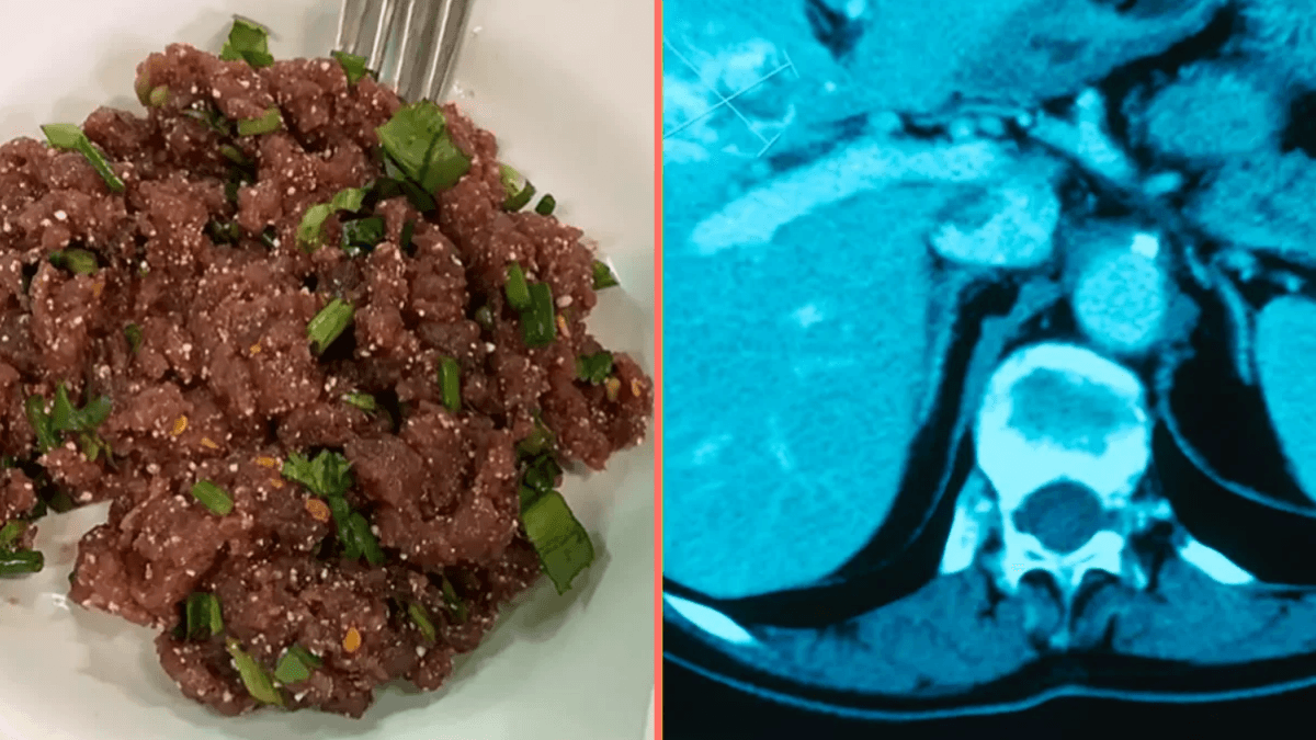 Single bite of popular Thai dish can give you liver cancer