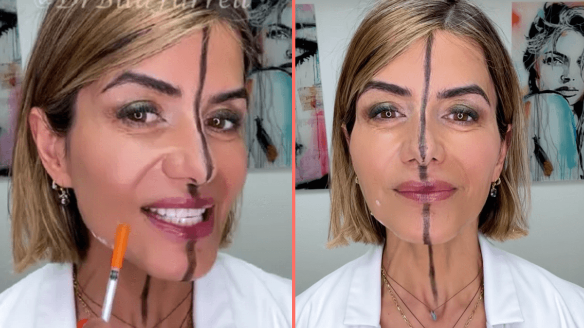 Doctor reveals the side effects of Botox after injecting only one side of her face