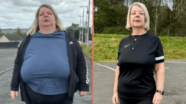 Woman loses 14 stone without calorie counting using simple ‘delay not deny’ principle Woman loses 14 stone without calorie counting using simple ‘delay not deny’ principle