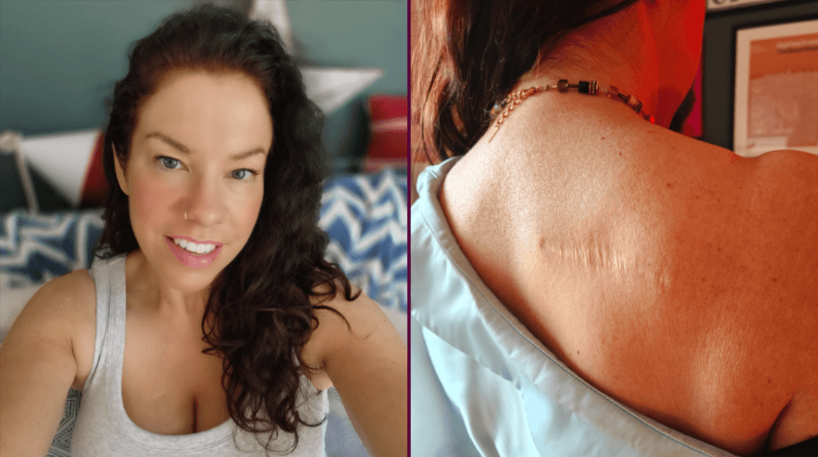 ‘I used sunbeds to get a tan to look healthy but, ironically, I’m far from healthy now’