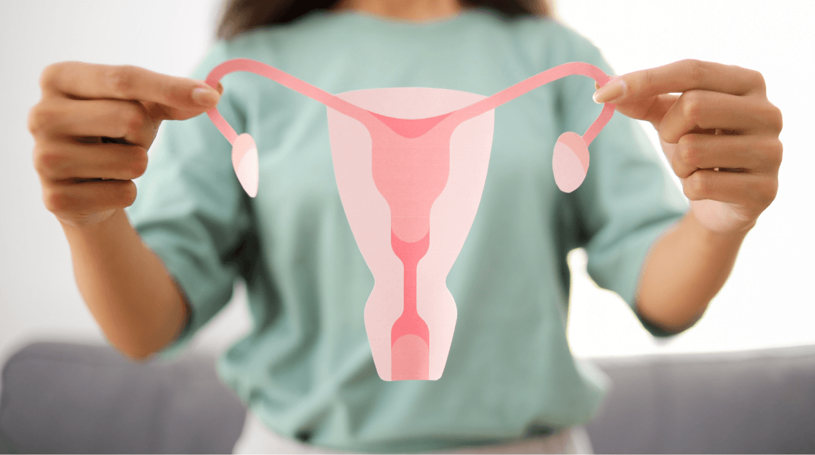 5 things all women should know about Polycystic Ovary Syndrome (PCOS)