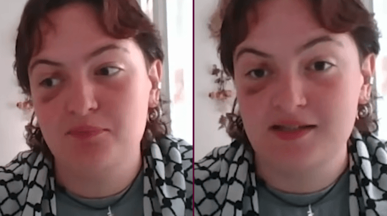 ‘I was beaten by German police at a Palestine march’ ‘I was beaten by German police at a Palestine march’