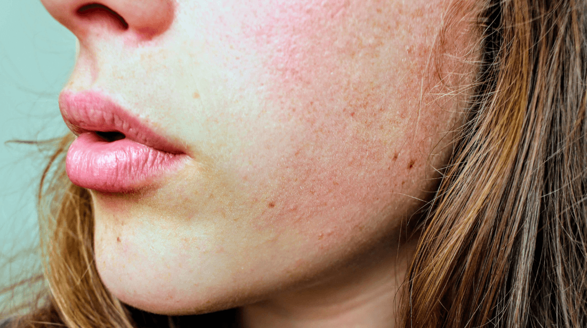 ‘A little goes a long way’ – The moisturiser people with dry skin won’t regret buying this winter