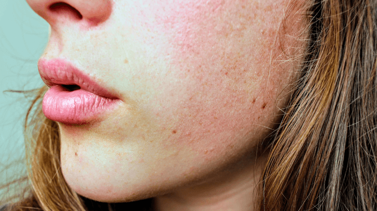 ‘A little goes a long way’ – The moisturiser people with dry skin won’t regret buying this winter ‘A little goes a long way’ – The moisturiser people with dry skin won’t regret buying this winter